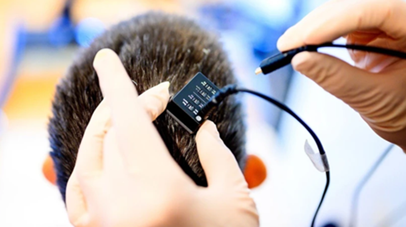 Công nghệ chuyển đổi tín hiệu não thành giọng nói: Cánh cửa giao tiếp mở lại cho người liệt sau gần hai thập kỷ im lặng